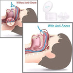 SleepFlow Nasal Breathing Aid