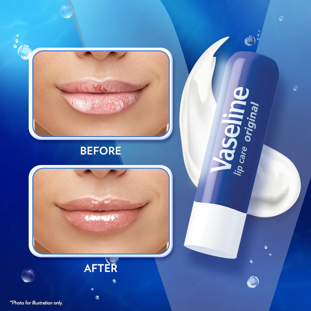 Vaseline - Lip Therapy Balm Stick