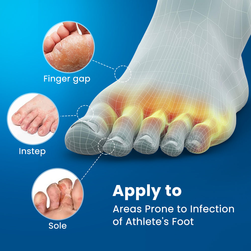 Sumifun - Toe Seam Itching Cream