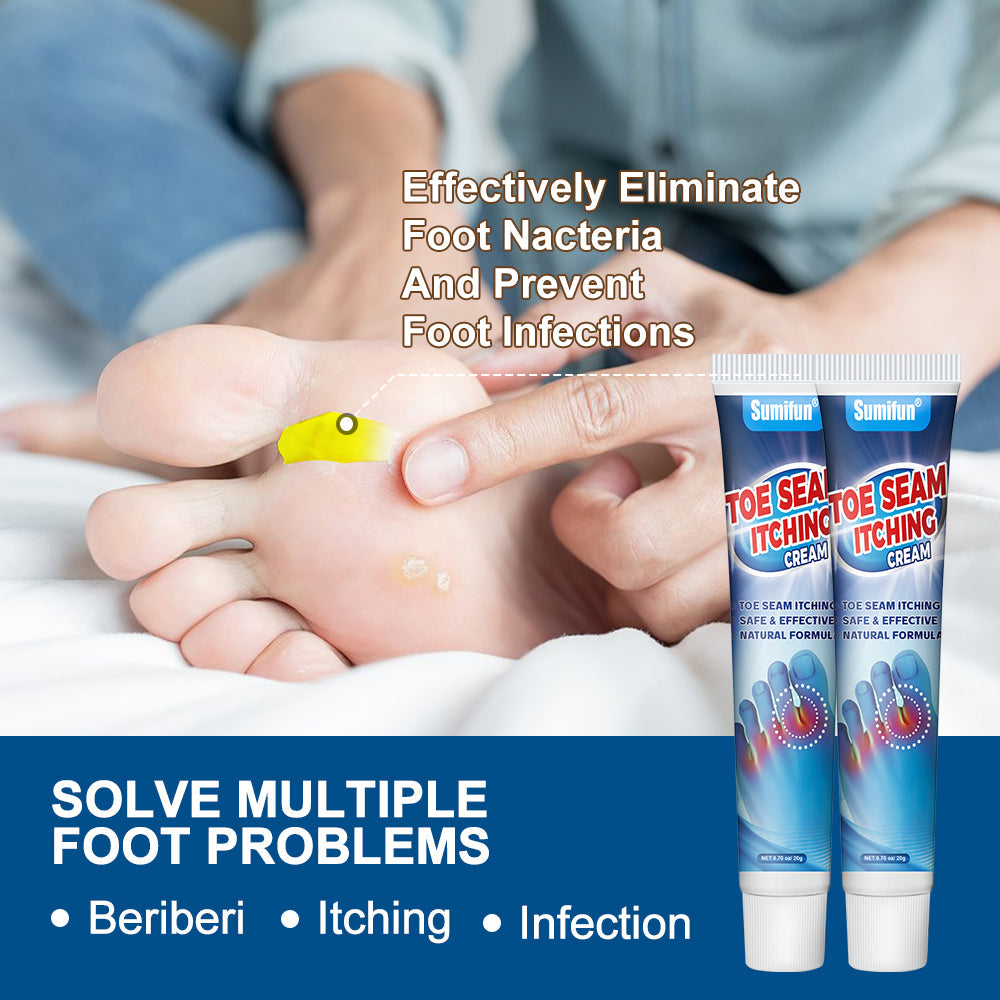 Sumifun - Toe Seam Itching Cream