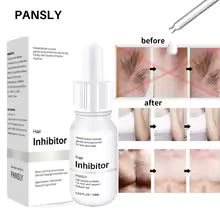 Professional Stop Hair Growth Inhibitor Serum Oil Painless Moisturizing Whitening Removal Non-irritating Skin Care Body Beauty