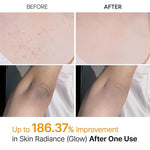 Dr.Melaxin - Peel Shot Kojic Acid Spray