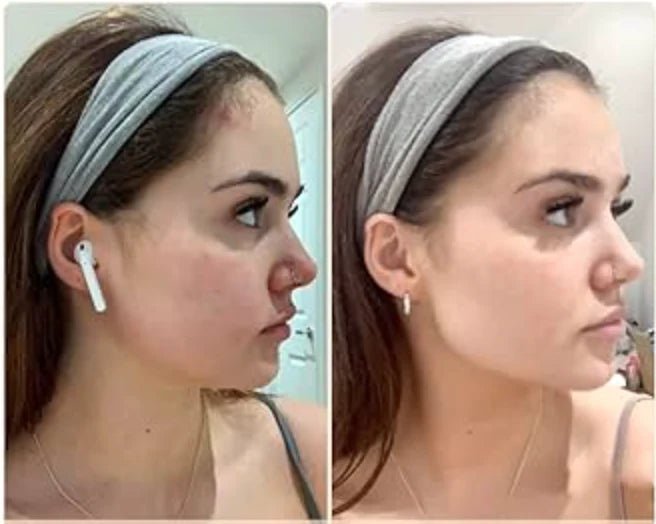 Face Massager ©