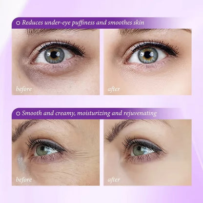 Instant Eye Bag Removal Cream Retinol Anti-Wrinkle Firming Skin Fade Fine Lines Anti Dark Circle Puffiness Brighten Eye skinCare