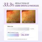 Mary & May - Glutathione Eye Cream Special Set