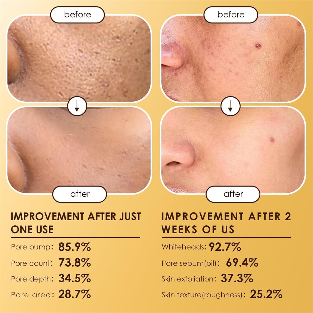 Moolinse Peel Shot P5 Exfoliant Ampoule (Pack of 2) ℗