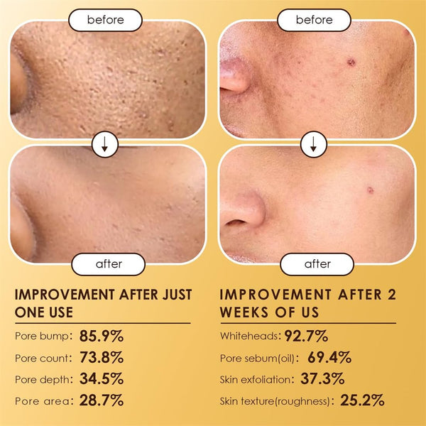 Moolinse Peel Shot P5 Exfoliant Ampoule (Pack of 2) ℗