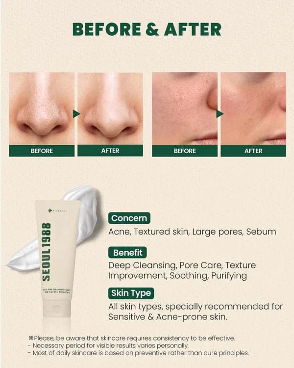Seoul 1988 Cleansing Foam (Pine Cica 1% + Probiotics)
