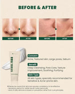 Seoul 1988 Cleansing Foam (Pine Cica 1% + Probiotics)